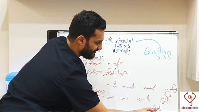 Master PR interval prolongation and shortening in 5 minutes! смотреть онлайн
