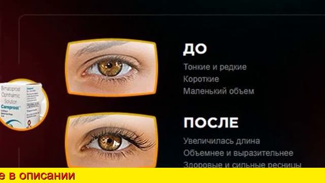 Аптека Озерки Карепрост смотреть онлайн