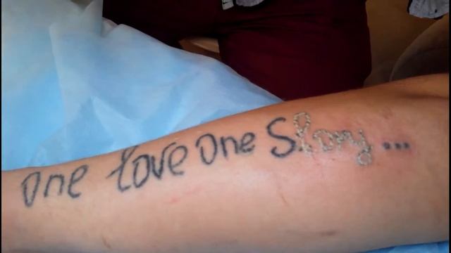 Удаление татуировоки неодимовым лазером процедура 1-ая