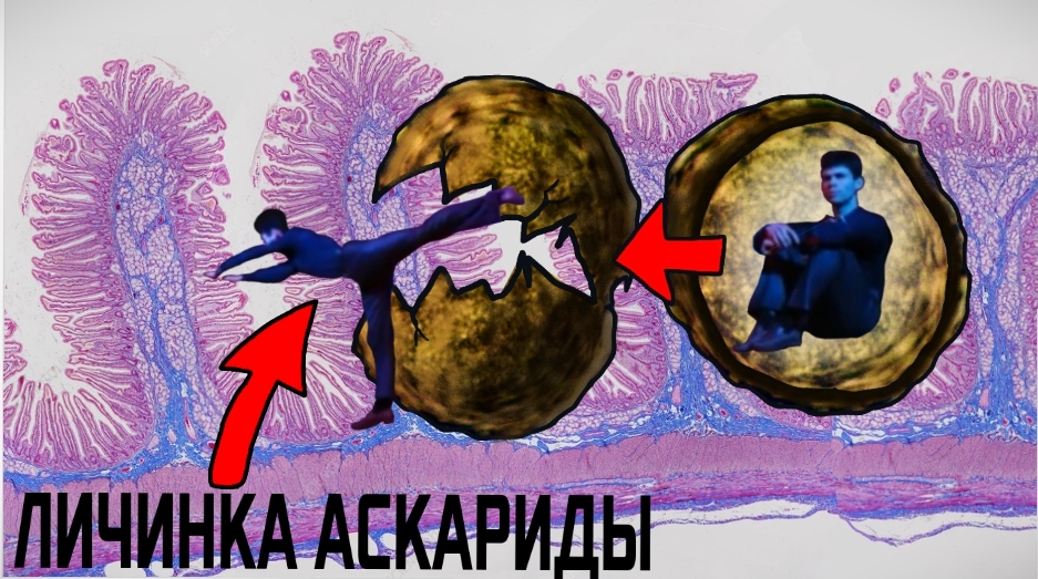 Что_ Где_ Когда__вопрос про паразита.mp4 смотреть онлайн