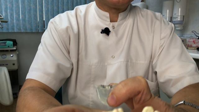 Имплантация зубов без разрезов! смотреть онлайн