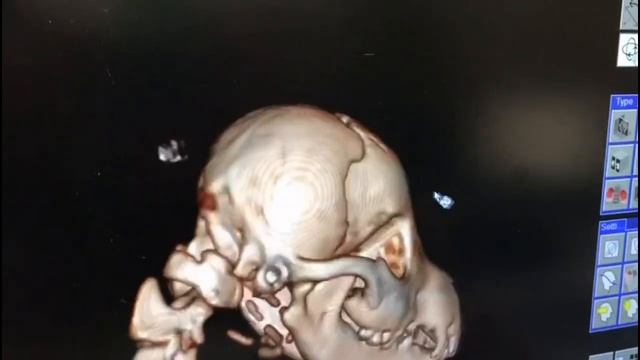 КТ собаки с черепно-мозговой травмой смотреть онлайн