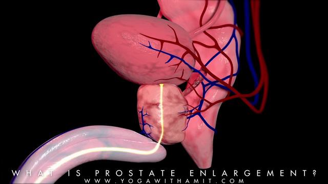 What is an Enlarged Prostate? смотреть онлайн