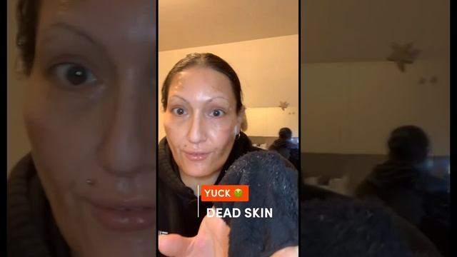 ⚠️WARNING⚠️ Gross Content ?Watch If You Dare! Aesthetic Maison Code: Beautiejunkie | #skincare смотреть онлайн
