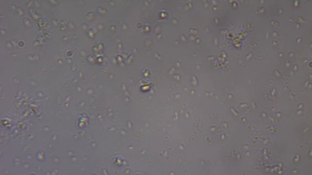 Сенная палочка из фитобактерина 40х 2 смотреть онлайн