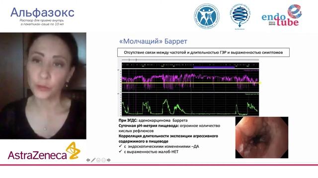 Пищевод Баррета: лечение ИПП и питание пациентов с ГЭРБ. В. О. Кайбышева