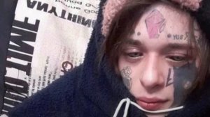 апфс-сонный паралич