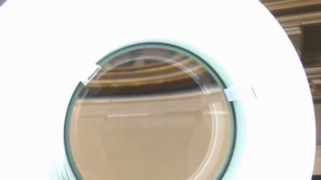 Ботокс, Диспорт, филлеры, контурная пластика. Шарыпова Инна Владимировна. КИЭМ.