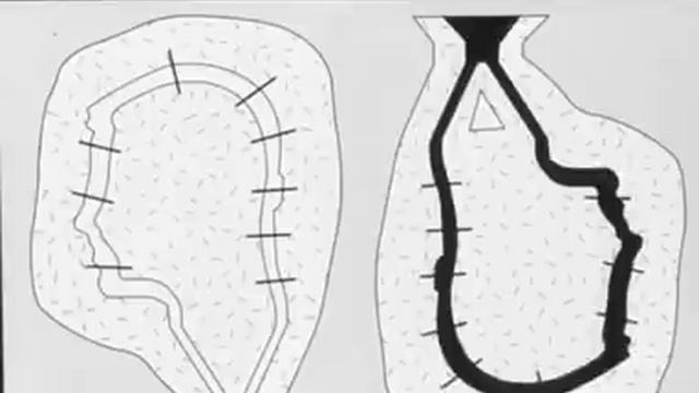 Литьё из бронзы