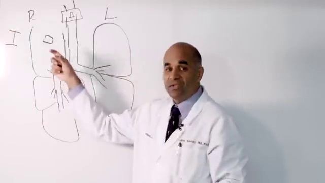 Stage 1 and Stage 2 Lung Cancer смотреть онлайн