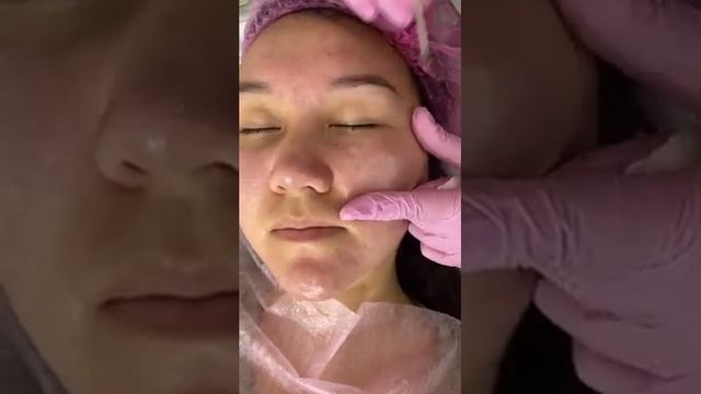 Угри нимадан Пайдо булиши хакида МАФТУНА КОСМЕТОЛОГ смотреть онлайн