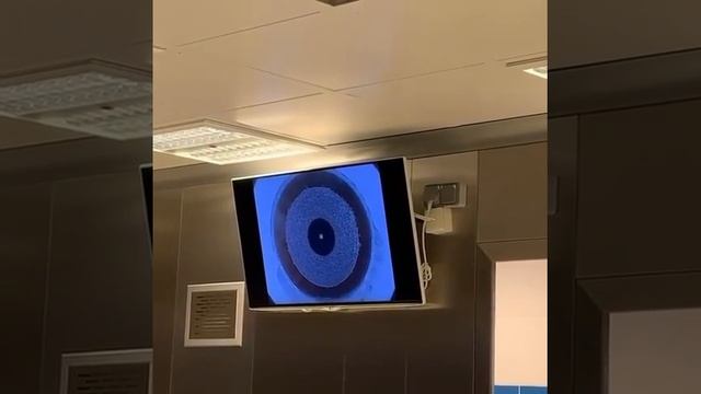 Лазерная коррекция зрения - отзыв смотреть онлайн