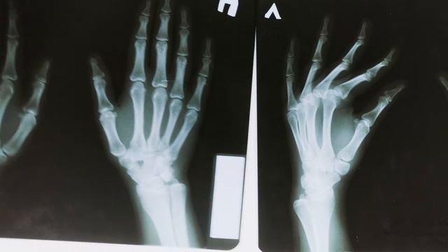 ПОЧЕМУ РАДИАЦИЯ ОПАСНА? ПОСЛЕДСТВИЯ ВОЗДЕЙСТВИЯ РАДИАЦИЙ