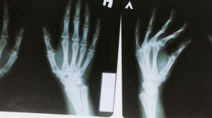 ПОЧЕМУ РАДИАЦИЯ ОПАСНА? ПОСЛЕДСТВИЯ ВОЗДЕЙСТВИЯ РАДИАЦИЙ