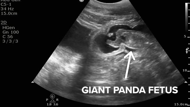 Giant Panda Ultrasound, August 17, 2020 смотреть онлайн