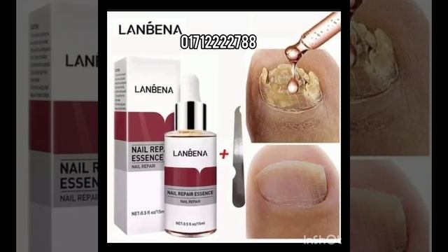 LANBENA Nail Repair Essence, 01712222788 смотреть онлайн