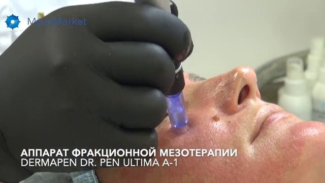Обзор аппарата фракционной мезотерапии Dermapen Dr. Pen Ultima A-1 смотреть онлайн