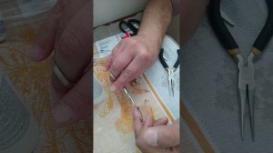 Как снять швы самостоятельно