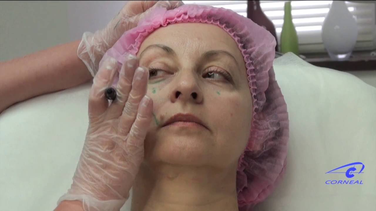 Получаем точку МакГрегора смотреть онлайн
