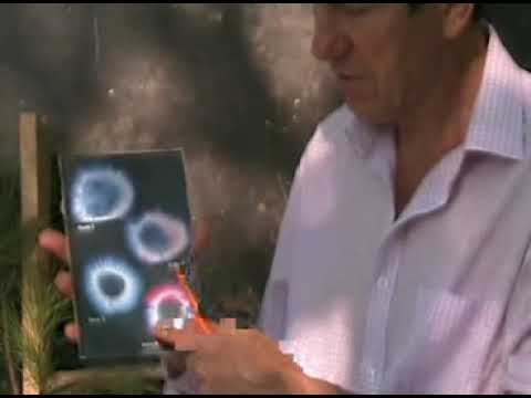 ЦЕНА НЕВЕЖЕСТВА ФИЛЬМ 2 КИРЛИАНОГРАФИЯ ( ЗАПОМНИ, БОЛЕЗНИ- ТВОИ СПАСИТЕЛИ!) смотреть онлайн