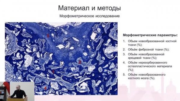 Регенерация хряща и кости. Bone end articular-tissue regeneration.