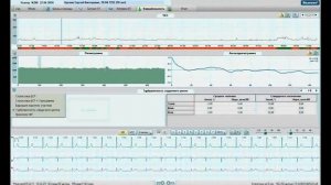 Обзор закладок в ПО Валента по холтеровскому мониторированию ЭКГ