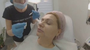 Ботулинотерапия средней и нижней трети лица. Musculus levator labii superioris, DAO, платизма.