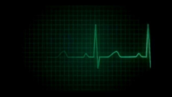 10 часов Пульс Сердца