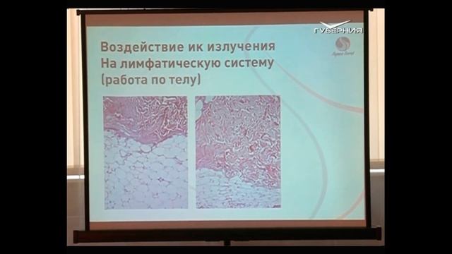 Косметологическое оборудование фотодинамической терапии ФДТ, на выставке Шарм-Profi Самара-Осень! смотреть онлайн