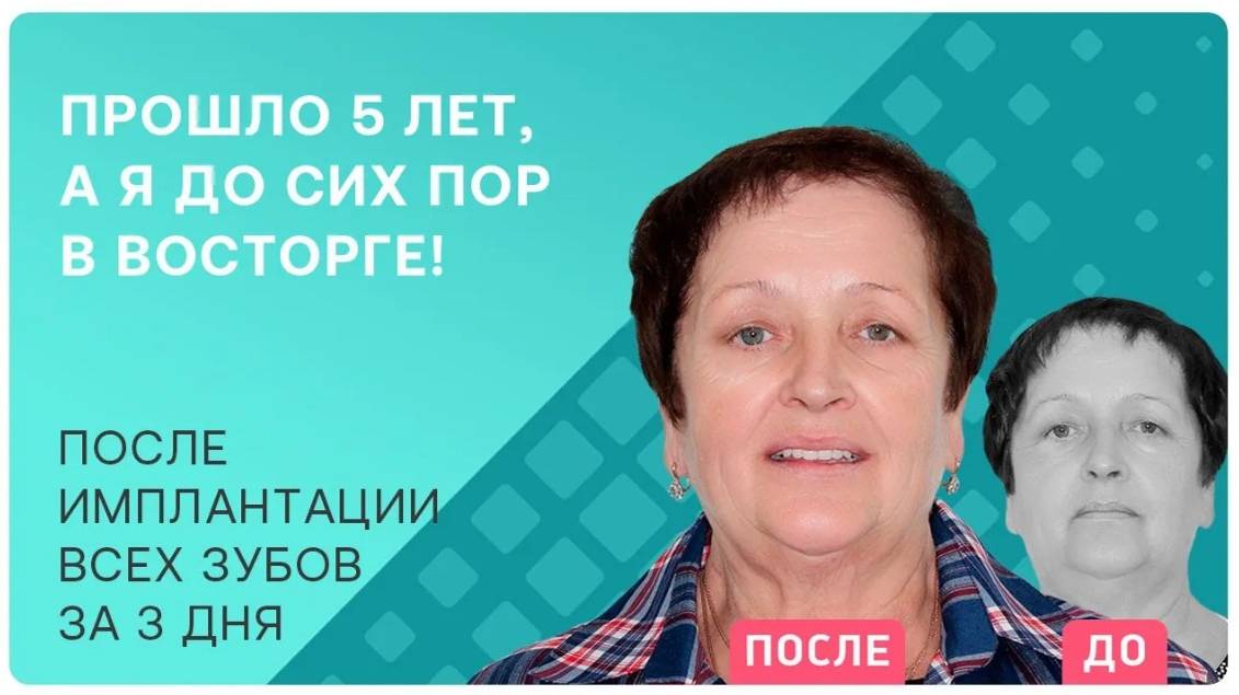 «Импланты не прижились, я не знала, что делать!»: реальная история успешной повторной имплантации
