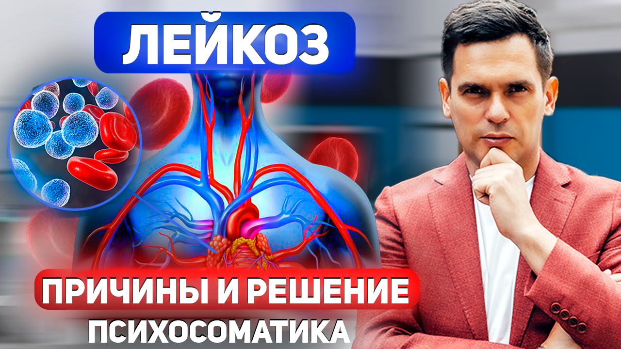 ЛЕЙКОЗ. В Чём Причина, Как С Ним БОРОТЬСЯ ? смотреть онлайн