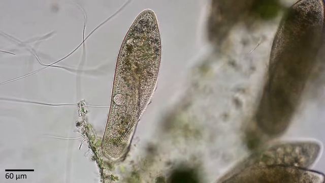 Инфузории - туфельки (Ciliates Paramecium caudatum). смотреть онлайн