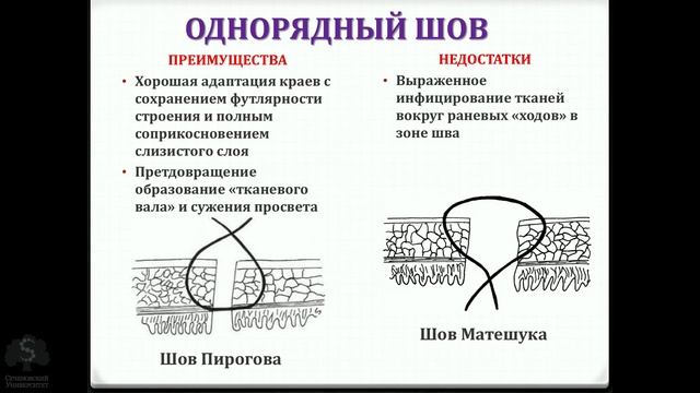 Кишечные анастомозы смотреть онлайн