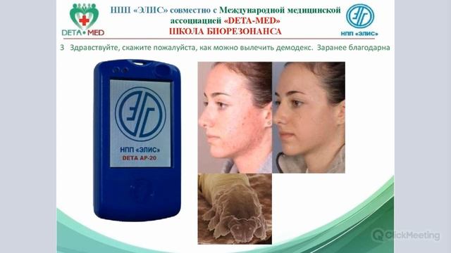 Демодекс Как лечить смотреть онлайн