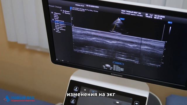 УЗИ сердца. Что входит? смотреть онлайн