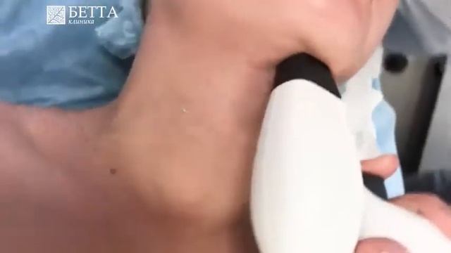 Rf-лифтинг на аппарате Viora. Коррекция второго подбородка, БЕТТА КЛИНИКА, Нижний Новгород. смотреть онлайн