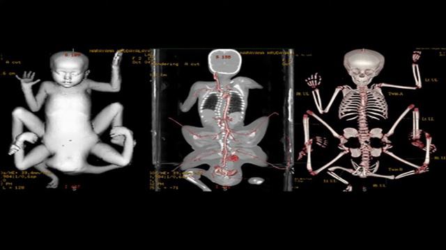 5 Shocking Medical Mysteries смотреть онлайн