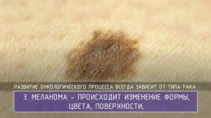 Рак кожи