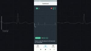 Монитор ЭКГ DuoEK ручной & носимый ЭКГ трекер, Приложение «ViHealth»