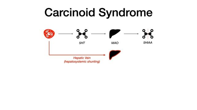 Lung Cancer/Tumors смотреть онлайн