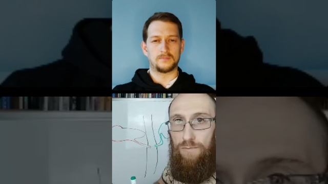 УДАЛЕННЫЙ ЖЕЛЧНЫЙ ПУЗЫРЬ // какие функции выполняет желч? смотреть онлайн