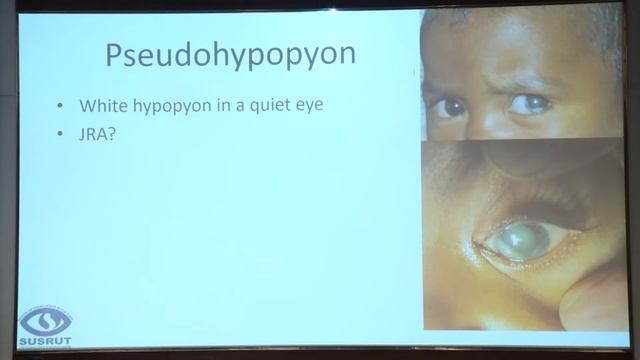 AIOC2022 IC492 Dr BHADURI ANIRBAN THE GREAT MASQUERADE смотреть онлайн