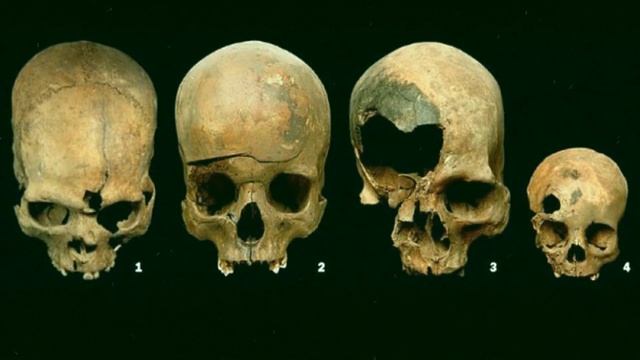 Почему пращники ценились выше лучников? смотреть онлайн