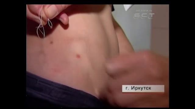 В Братске нет вакцин от клещевого энцефалита смотреть онлайн