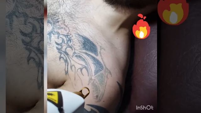 Как удалить татуировку в Москве?вот так) смотреть онлайн