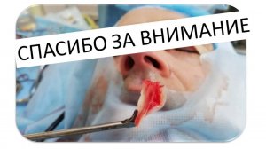 ЭНДОСКОПИЧЕСКАЯ СЕПТОПЛАСТИКА