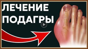 ЛЕЧЕНИЕ ПОДАГРЫ НАРОДНЫМИ СРЕДСТВАМИ.mp4