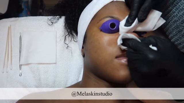 BEST FACIAL IN NYC | ENZYMATIC EXFOLIATION & HYDRO JELLY MASK смотреть онлайн