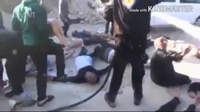 асад, Истребление детей путем химического газа. Сирия (Видео не для маленьких детей) смотреть онлайн
