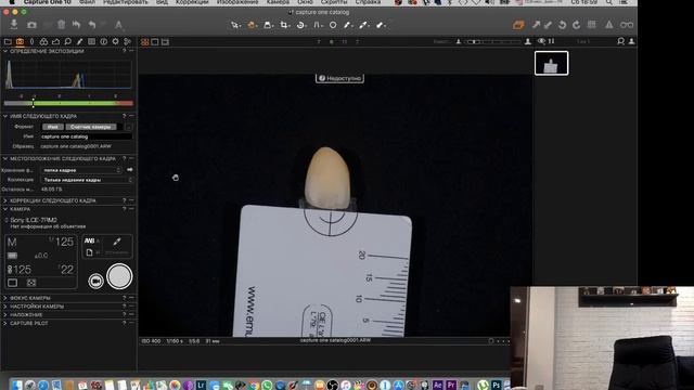 Прямая трансляция. Дентальная фотография. Снимаем в RAW формате. смотреть онлайн